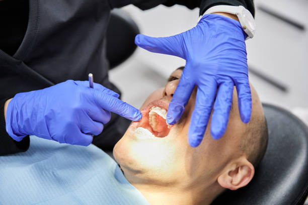 Best Emergency Treatment for Toothache in Lake Caroline, VA